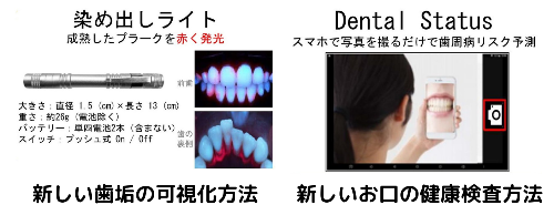 写真：糖尿病予防を推進するための歯の健康増進の実証実験